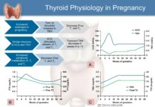 Maternal thyroid hormones are critical for fetal brain development