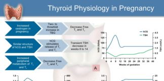 Maternal thyroid hormones are critical for fetal brain development