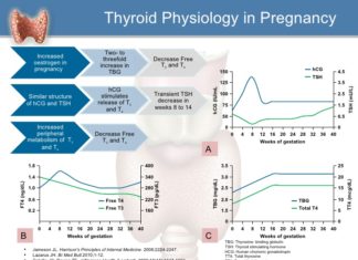 Maternal thyroid hormones are critical for fetal brain development