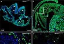A single gene from the mother plays such a crucial role in the development of the placenta that its dysfunction leads to miscarriages