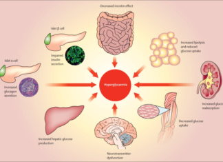 Research : Natural molecule may be key to reversing and halting heart disease in diabetes