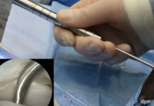 Near infrared spectroscopy probe for evaluation of articular cartilage and subchondral bone structure and composition