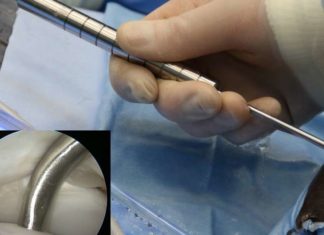 Near infrared spectroscopy probe for evaluation of articular cartilage and subchondral bone structure and composition