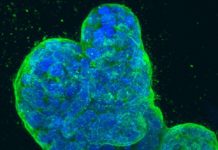 New hope : First immunotherapy success for triple-negative breast cancer