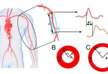 New non-invasive blood pressure monitoring possible using pulse waves