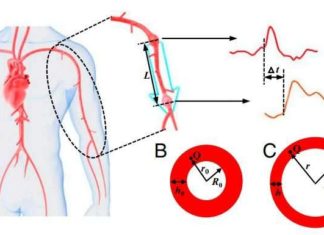 New non-invasive blood pressure monitoring possible using pulse waves