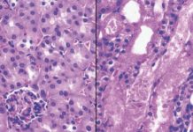 Nicotinamide adenine dinucleotide (NAD+) is a major player in nutrition today