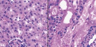 Nicotinamide adenine dinucleotide (NAD+) is a major player in nutrition today