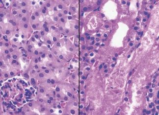 Nicotinamide adenine dinucleotide (NAD+) is a major player in nutrition today