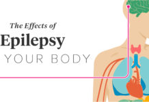 People with temporal lobe epilepsy also have high rates of problems with their reproductive endocrine systems