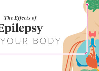 People with temporal lobe epilepsy also have high rates of problems with their reproductive endocrine systems