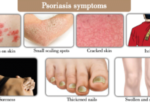 One day people with psoriasis may be able to simply go online to receive their care
