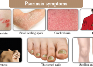 One day people with psoriasis may be able to simply go online to receive their care
