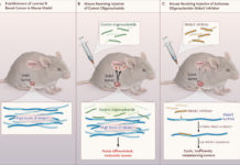 Researchers discovered that RNA (MALAT1) appears to suppress breast cancer metastasis