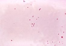 Researchers have developed a test that could rapidly parse out infections of the brain from other diseases