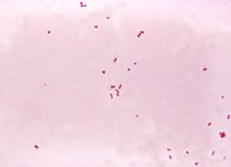 Researchers have developed a test that could rapidly parse out infections of the brain from other diseases
