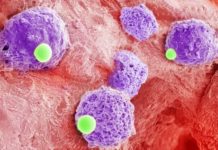 Researchers have developed a therapy that could help strengthen existing treatments for acute myeloid leukemia