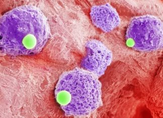 Researchers have developed a therapy that could help strengthen existing treatments for acute myeloid leukemia