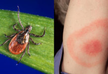 Researchers have developed techniques to detect Lyme disease bacteria weeks sooner than current tests
