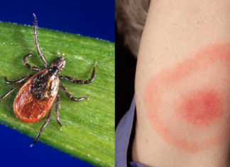 Researchers have developed techniques to detect Lyme disease bacteria weeks sooner than current tests