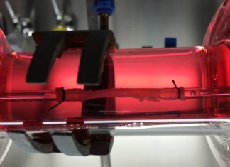 The world’s first functional oesophagus engineered from stem cells has been grown and successfully transplanted
