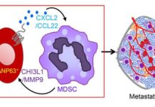 Triple-negative breast cancer : Immune cells offer potential therapeutic target