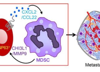 Triple-negative breast cancer : Immune cells offer potential therapeutic target