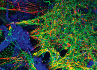 Tufts University : grow functioning human neural networks in 3-D from stem cells
