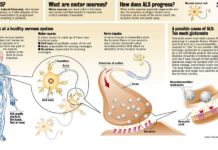 New light on the potential origins of a host of incurable disorders, from amyotrophic lateral sclerosis (ALS) to inclusion body myopathy to certain forms of muscular dystrophy