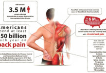 Health insurer policies discourage use of non-opioid alternatives for lower back pain