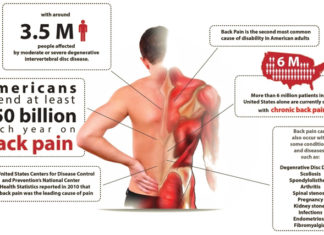 Health insurer policies discourage use of non-opioid alternatives for lower back pain