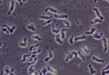 ‘Brain-Eating’ Amoeba – Fabrizio Stabile died after contracting the amoeba