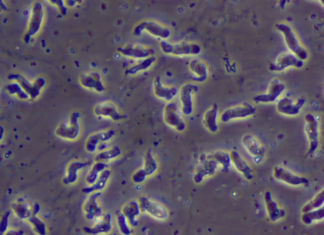 ‘Brain-Eating’ Amoeba – Fabrizio Stabile died after contracting the amoeba