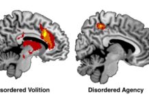 Brain networks involved with free will – new study related to movement decisions