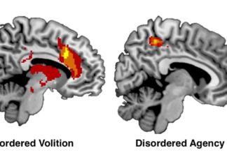Brain networks involved with free will – new study related to movement decisions