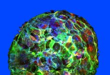 Discovered new connection between Cancer and Fluid Physics