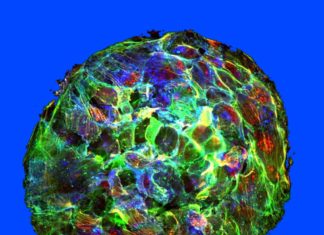Discovered new connection between Cancer and Fluid Physics