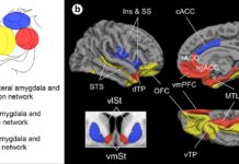 In children with ASDs the amygdala connections with other parts of the brain proved to be weaker with some regions