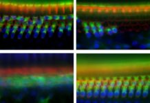 Discovered a gene that plays an essential role in noise-induced deafness