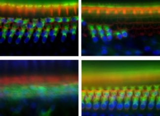 Discovered a gene that plays an essential role in noise-induced deafness