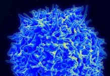First ever CAR therapy licensed for the treatment of lymphoma available to patients