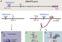 A genetic defect associated with als causes changes how cells starved of sugar metabolize fatty compounds known as lipids