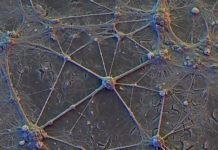 Human dendrites have different electrical properties from those of other species