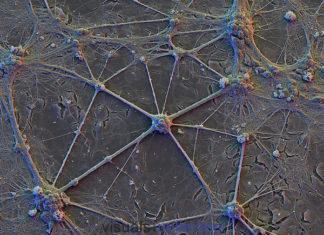 Human dendrites have different electrical properties from those of other species