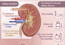 Renal failure : Keeping phosphorus under control to improve the life quality of patients