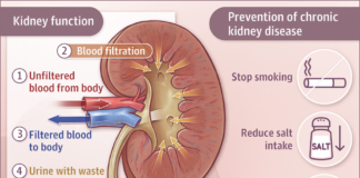 Renal failure : Keeping phosphorus under control to improve the life quality of patients