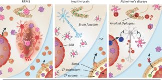 Targeting immune checkpoints activity – microglial – may reduce inflammation in neurodegenerative diseases
