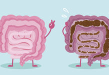 Women who are overweight or obese have up to twice the risk of developing colorectal cancer before age 50