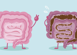 Women who are overweight or obese have up to twice the risk of developing colorectal cancer before age 50