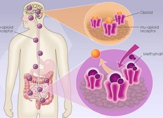 Traditional laxatives are recommended as first-line agents to treat patients with a confirmed diagnosis of opioid-induced constipation (OIC)